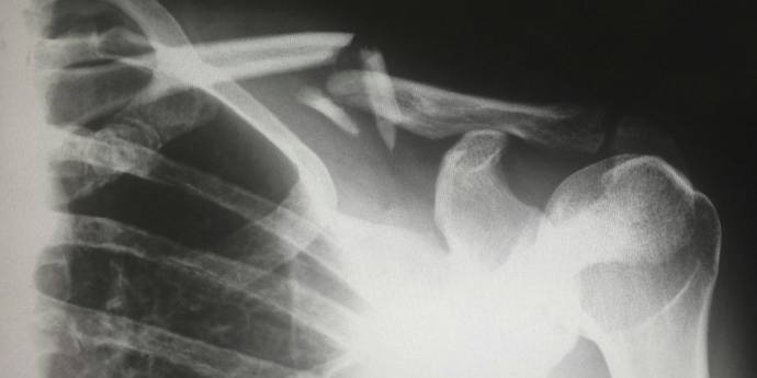 Injury impact: the proof is in productivity